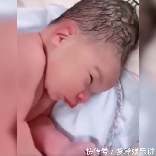 头骨|产妇分娩时不懂正确用力,婴儿头部被严重挤压,网友:很像寿星公