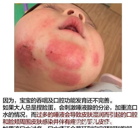 口水疹|郎朗晒娃又被批?这次冤枉!新手准爸妈还有哪些母婴常识需注意?