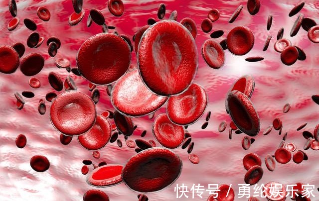 症状|血脂高不高,看头就懂,若没有出现这3大症状,你就知足吧