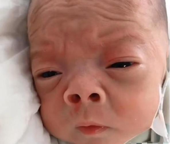 浮肿|“丑哭宝妈”的网红宝宝逆袭成功,被嫌弃长大,如今美得判若俩娃