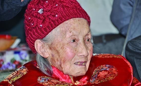 血脂块|110岁长寿老人，血管仅60岁且不堵，秘诀不是少吃肉，而是这3件事