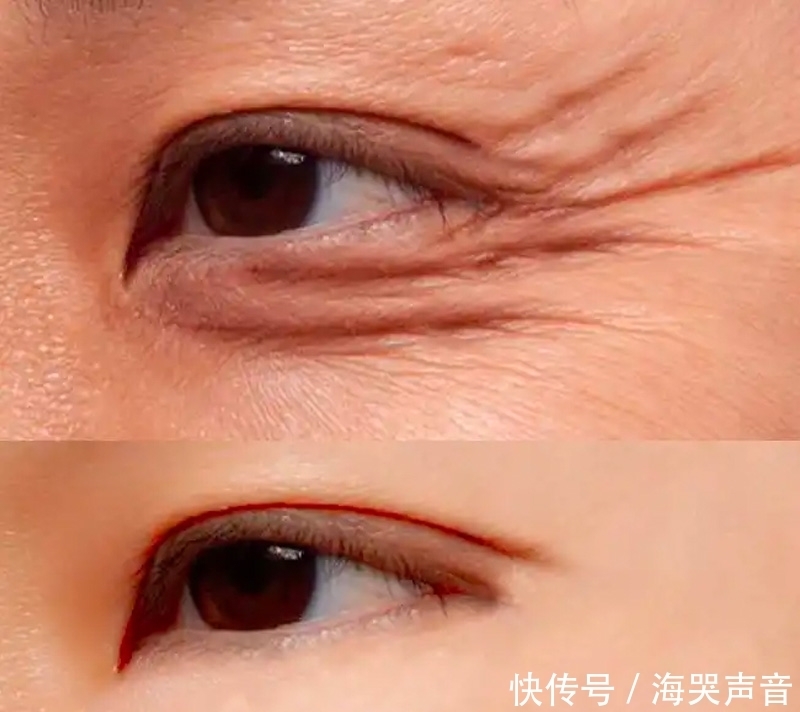 多数女人瞧不起这“乳膏”,殊不知老外当宝用,效果真心不错