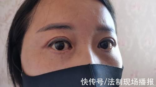 榆阳区卫生局卫生监督所|女子割双眼皮后眼睛“闭不上”，市场监管局:无证经营