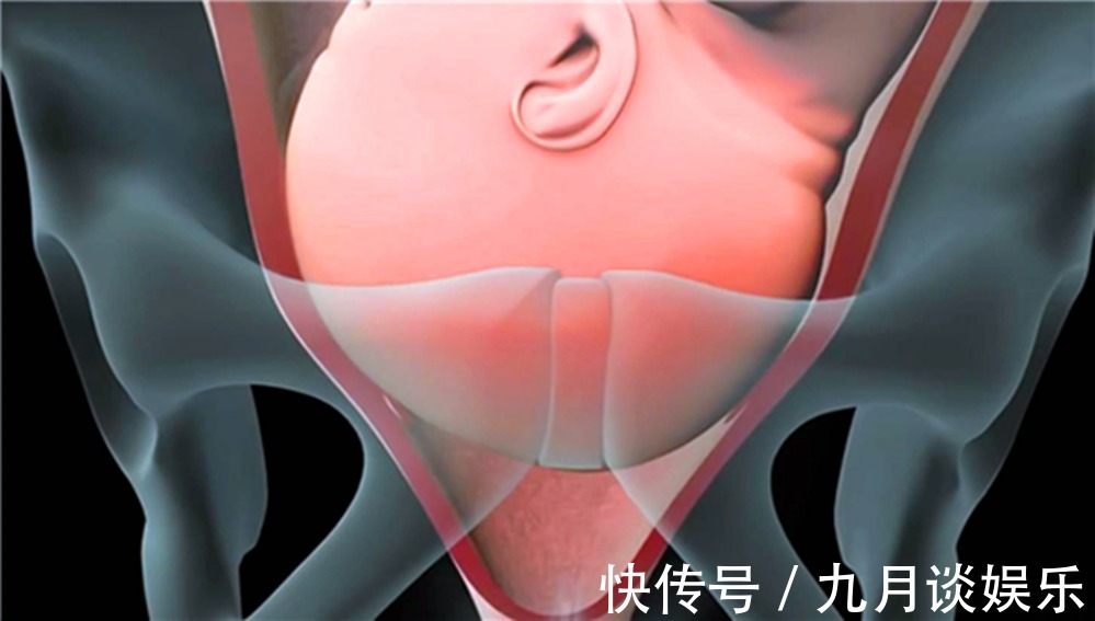 宝妈|生孩子不只孕妈痛,宝宝在腹中也“拼了”!看完全过程被暖哭