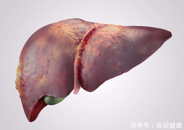  找上门|有这4种肝病的人，拖着不管，当心会被肝硬化“找上门”，需重视