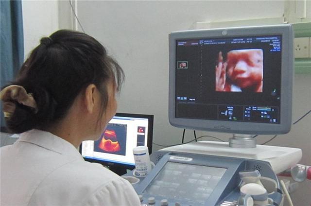 四维彩超|孩子腹中“比心”火了,四维彩超下的孩子动作暖心,医生:太有爱