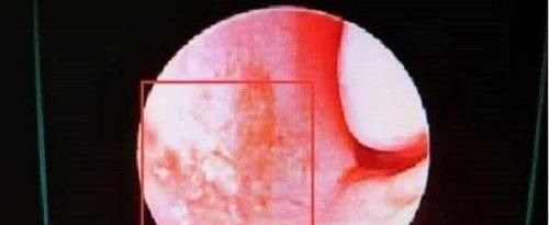 宝妈|4岁男孩鼻血不止,送医院被告知“无法抢救”,只因宝妈这一举动