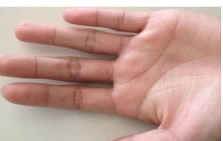 先知|肝不好，“手”先知，双手出现3种症状，或是肝脏“求援”早预防