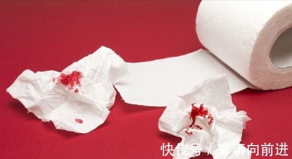 阿姨|45岁阿姨便秘半年,一查是肠癌晚期,身体出现3个症状,要小心