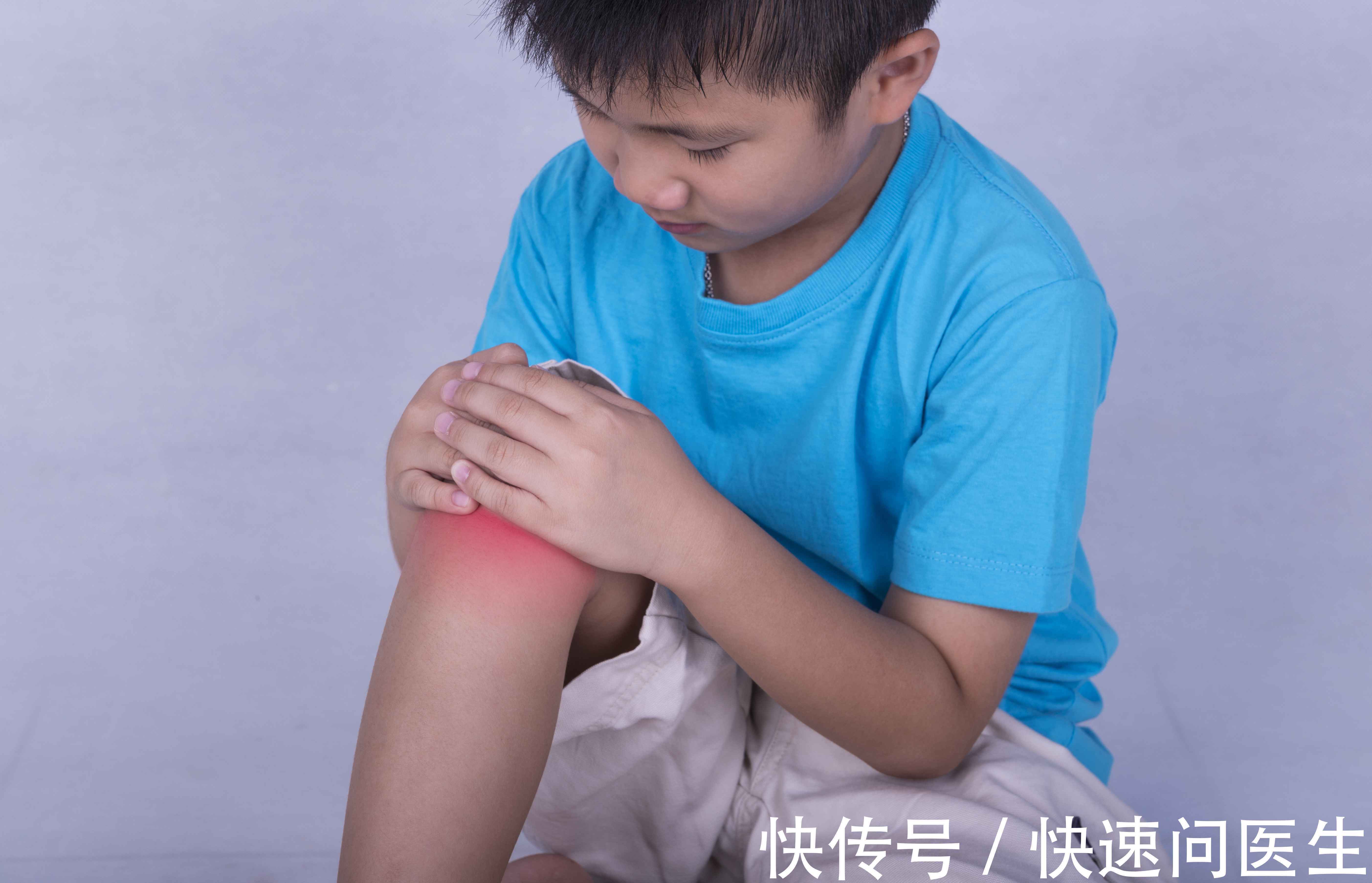 膝关节滑膜炎|孩子常喊腿疼是怎么回事？医生：多半都与这4个原因有关，别忽视