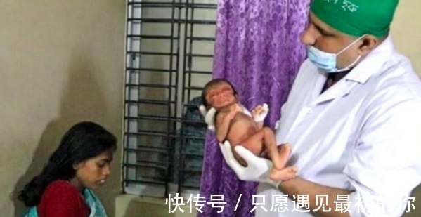 奇葩|国外奇葩婴儿“返老还童”,一出生如同80岁老头,父母不惊反喜!