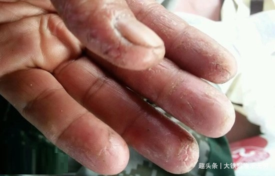 钓鱼人的“悲哀”也许这3种病就是我们的归宿,请不要再耍虎了!