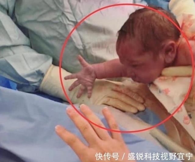 子宫|“最心急宝宝”走红,刚出娘胎就急着向妈妈求抱抱,网友太暖心