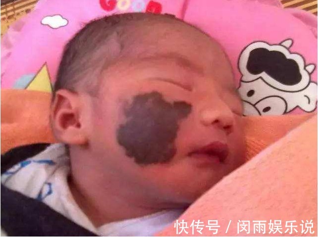tips|孕期受到三种影响,会让宝宝有“胎记”,可不是碰一下那么简单