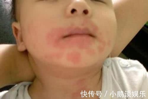 纸巾|湿纸巾成了毒纸巾?这5款婴幼儿湿巾被查出含甲醛,许多家长爱用