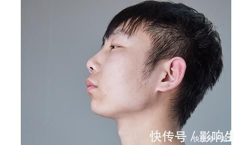 肿瘤医生|肿瘤医生:身体频繁有3个迹象,或是甲状腺癌“一级预警”