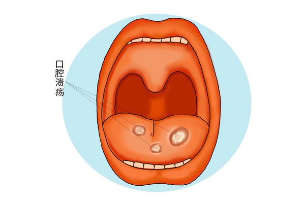 每天吃两片维生素B,身体会有怎样变化?好事还是坏事?