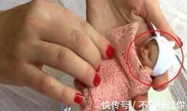 女孩|18年前那个只有25厘米,体重才半斤的女孩,如今怎样了?