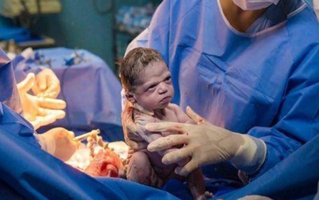 表情包|巴西女宝出生表情走红,怒目圆瞪看着医生,网友:全新表情包来了