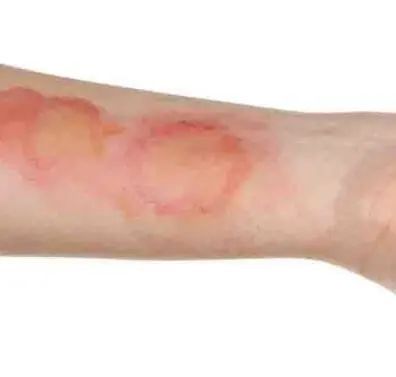 创可贴|小小的创口贴，学问可不少