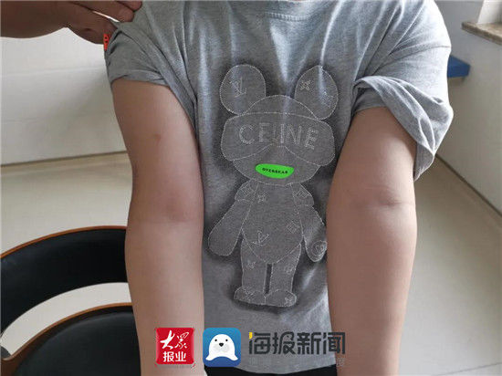 屈曲|帮助12岁“折翼天使”重拾自信一封来自患者的感谢信