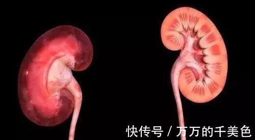 九蒸九晒黑芝麻丸|肾不好的人,身上会有2处发臭,2处发黑,若都没有,恭喜你了