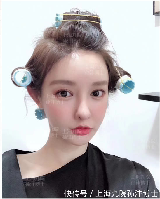 手术 眼修复孙沣博士:双眼皮术后是否会产生疤痕和增生?