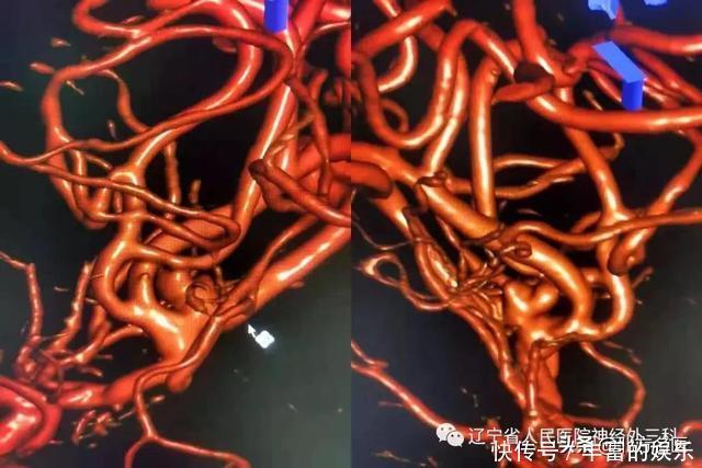 醒来|7岁男孩突然昏迷,醒来后说“妈妈,我要抱抱”