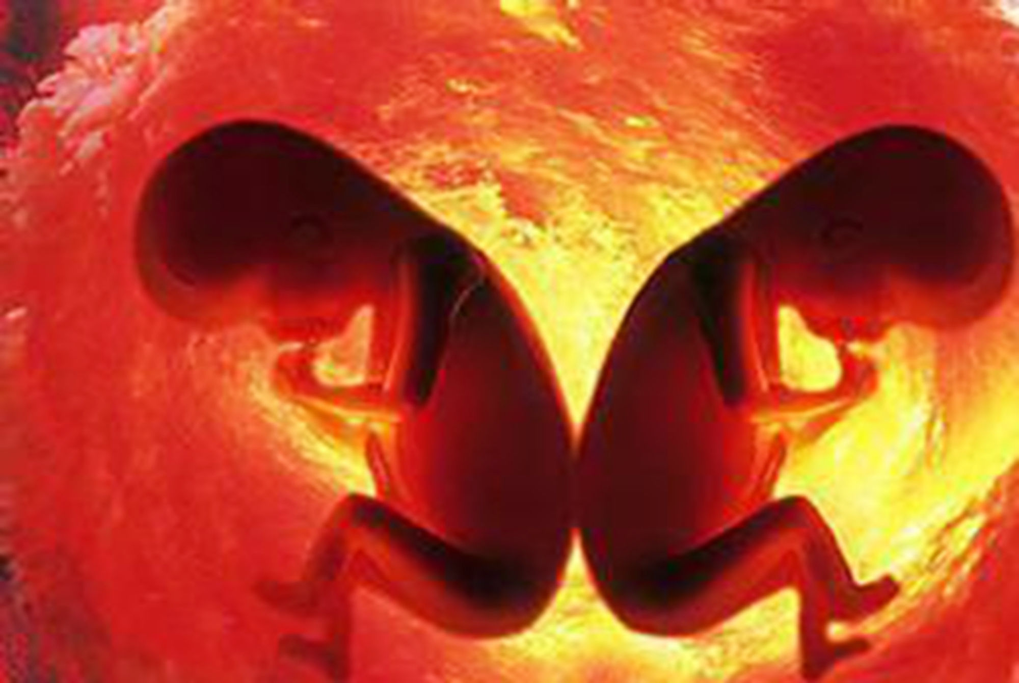 双顶径|四维彩超上藏着这些小秘密,孕妈能读懂吗?关系胎儿的发育状况