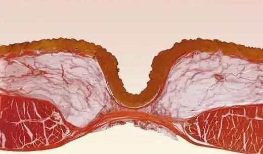 肚脐眼窝里的“黑泥”,到底是如何形成的,需不需要进行清理呢