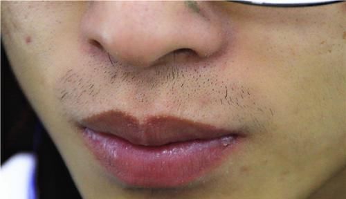 荷尔蒙|雄激素快要“干涸”的男性，跟常人有何不同？想要补充吃什么好？