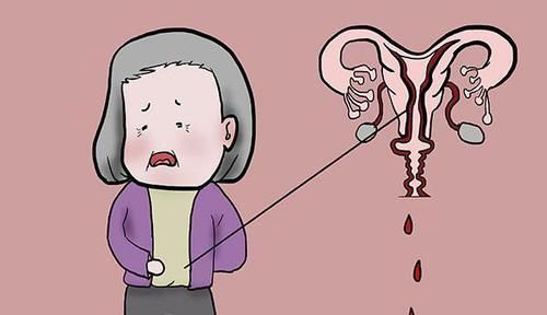 女性没了子宫会怎么样身体发生的变化,多数女性或难以接受