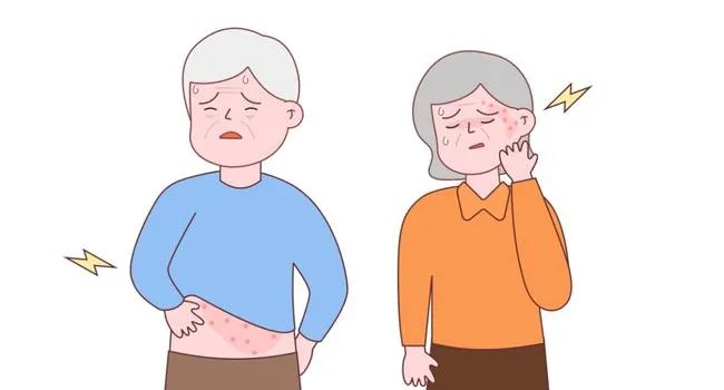 神经节|痛得要命！73岁阿姨脸上冒出连串的“北斗七星”，只因病毒深藏不露