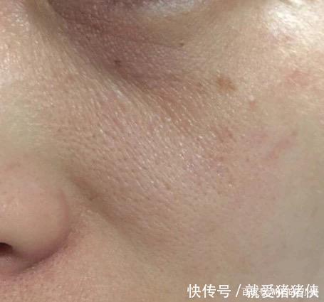 皮肤“干净”的女生,才是真的气质好看!这个护肤细节很值得学