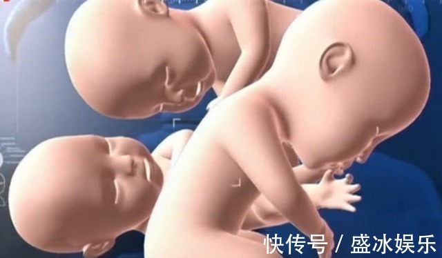 琳琳|孕妇怀四胞胎以为是儿子,结果生四个女儿,爸爸产房外手舞足蹈