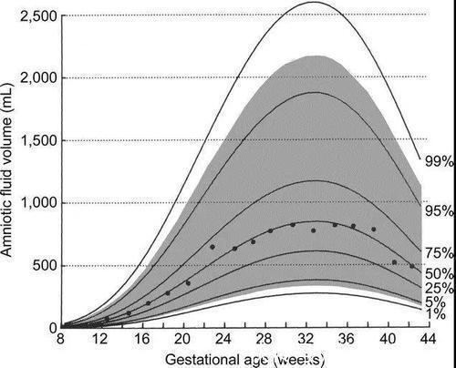 孕产妇保健手册|3类食物会降低羊水质量,影响宝宝发育,这些表现说明羊水好