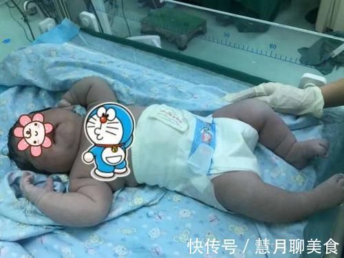 小霞|宝宝脸上产钳印难消,婆婆抱怨儿媳没本事,儿媳一句话回怼太解气