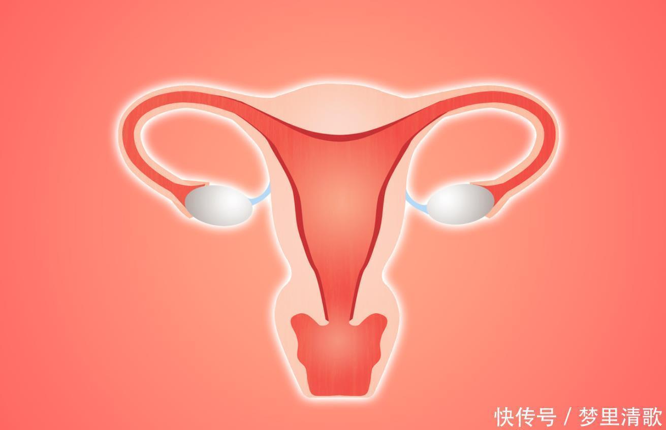 性生活|子宫肌瘤是怎么回事5类女性易患子宫肌瘤