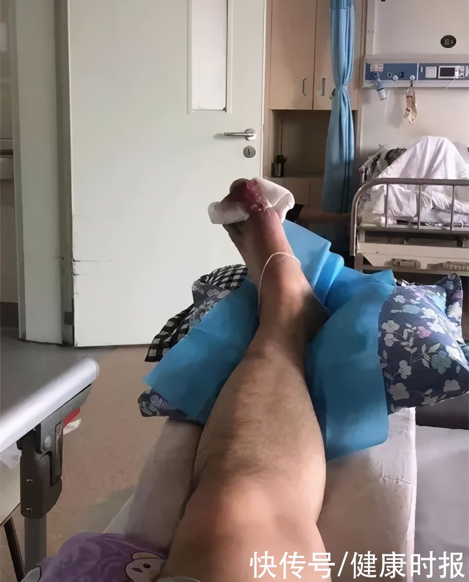 风湿免疫|看着太痛了！他拿剔骨刀给自己“做手术”，竟是因为爱喝这个