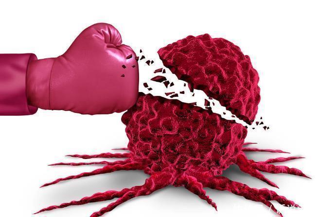 癌细胞|肿瘤与癌症不是同一种疾病关于4大区别要牢记，别再傻傻分不清