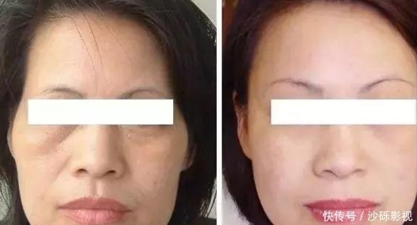 皱纹|药店最不起眼的一款“精华液”,美白抗衰去皱纹,网友堪称平价兰蔻