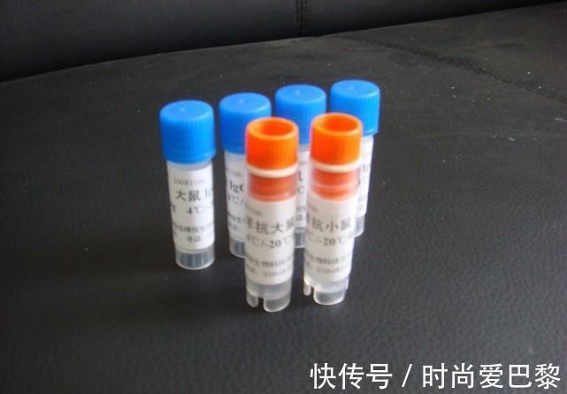 甘油三酯|高血脂“缠上”的人，都有4个特征，占得越多，血脂超标越严重