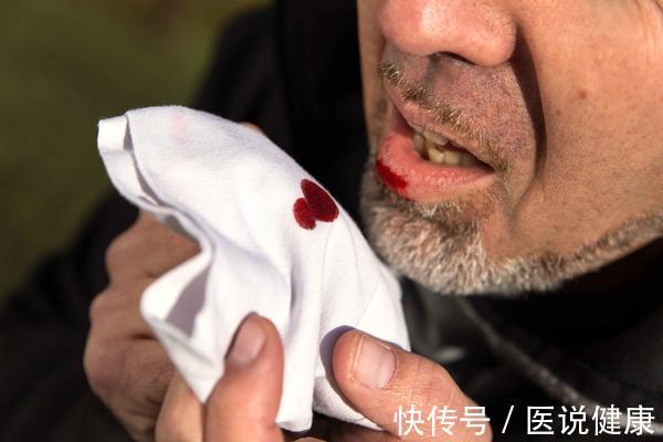 发烧|癌症来临时,身体发出的这5个征兆,及时抓住,尽早治疗十分关键