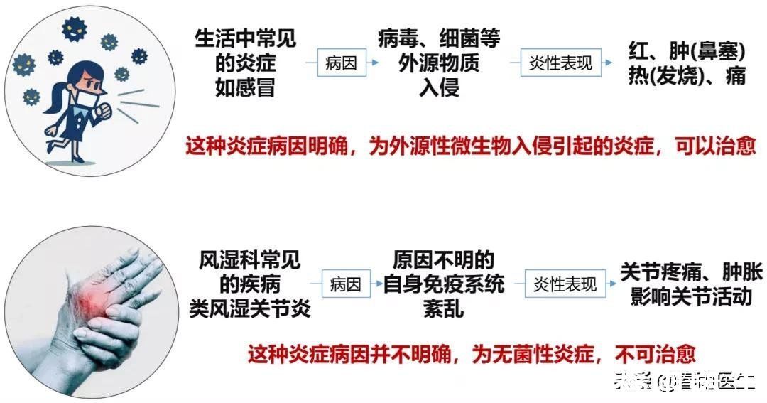 类风湿|早上起床手指僵硬疼痛？警惕类风湿找上门