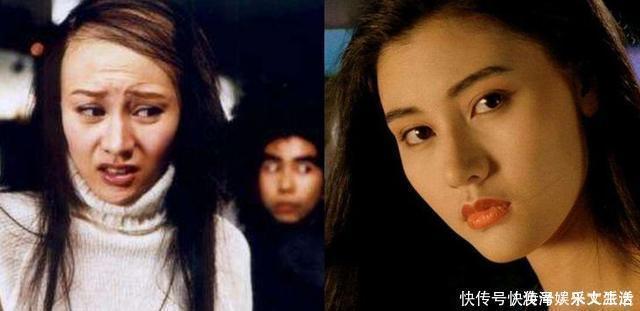 初恋这件小事|女明星注射面部逐渐“馒化”,要不要去整容?先问问她们再说吧!