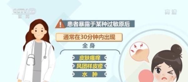 警惕！这些症状可能是严重过敏反应→