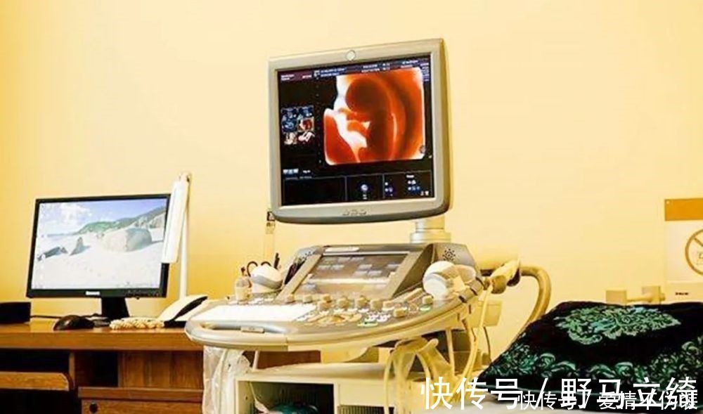 鉴定|一张四维彩超轻松看出胎儿性别,孕妈先别高兴的太早