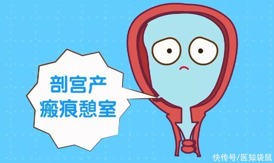 子宫|妈妈们注意！剖腹产后月经淋漓不尽，警惕子宫瘢痕憩室