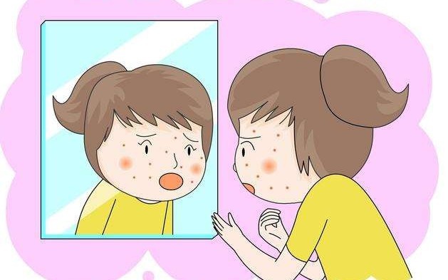 脓疱|痤疮按严重程度分4级,你是哪一级?另附一份有效治疗方法建议收藏!