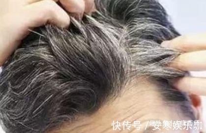 肾气|五脏是否健康?看一眼头发就知道!中医2招,白发转黑,五脏健康